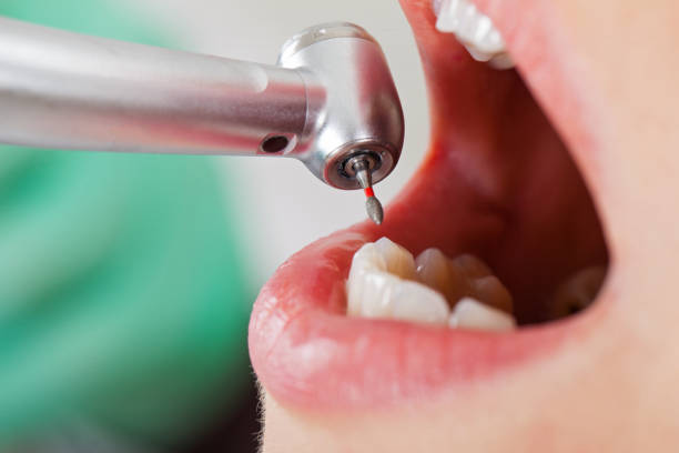 Best Emergency Dentist Near Me  in Ventress, LA